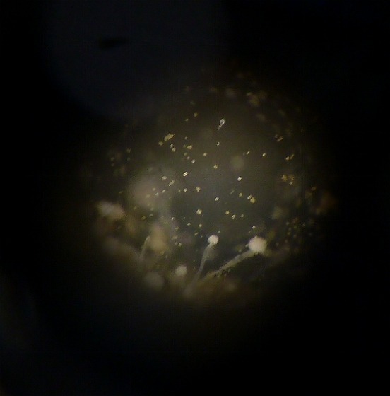 世界一の醤油をつくりたい　湯浅醤油有限会社　社長　新古敏朗のブログ-麹菌　顕微鏡